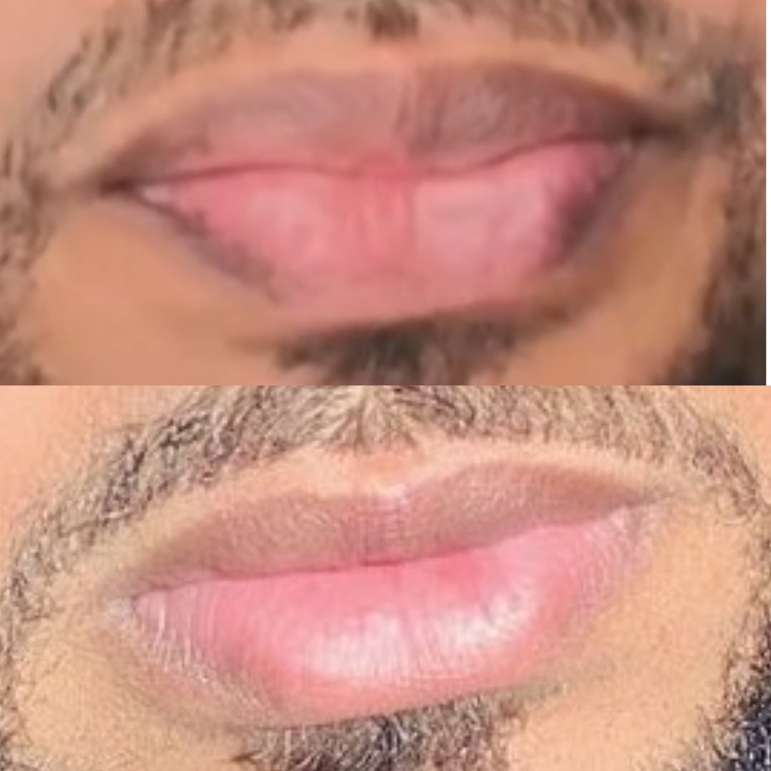 Lip Brightening Sample Kit (Mens) Lip Balms & Treatments Lip Tease by Dallace