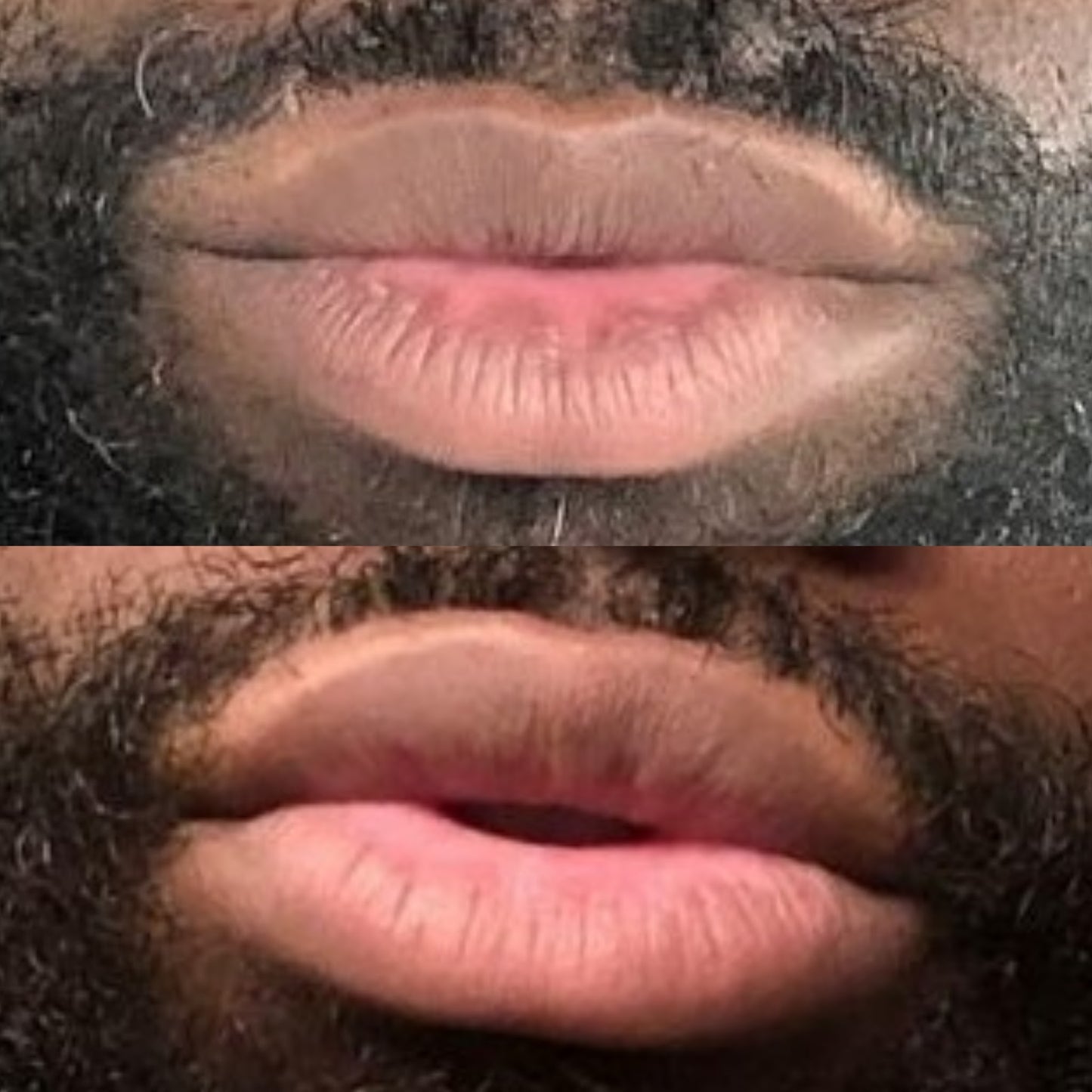 Lip Brightening Sample Kit (Mens) Lip Balms & Treatments Lip Tease by Dallace