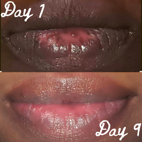 Lip Brightening Sample Kit (Womens) Lip Balms & Treatments Lip Tease by Dallace