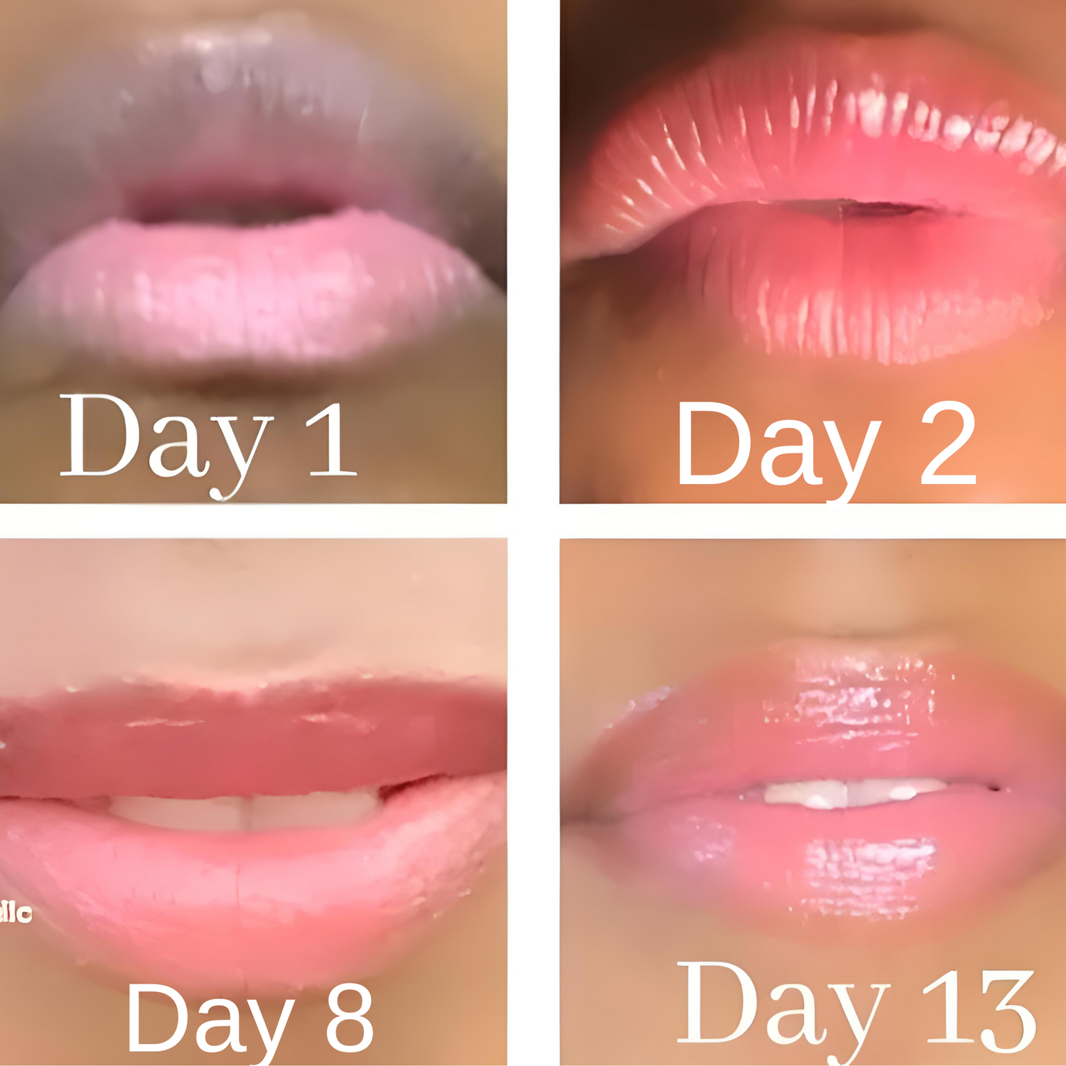 Lip Restoration Kit Lip Balms & Treatments Lip Tease by Dallace