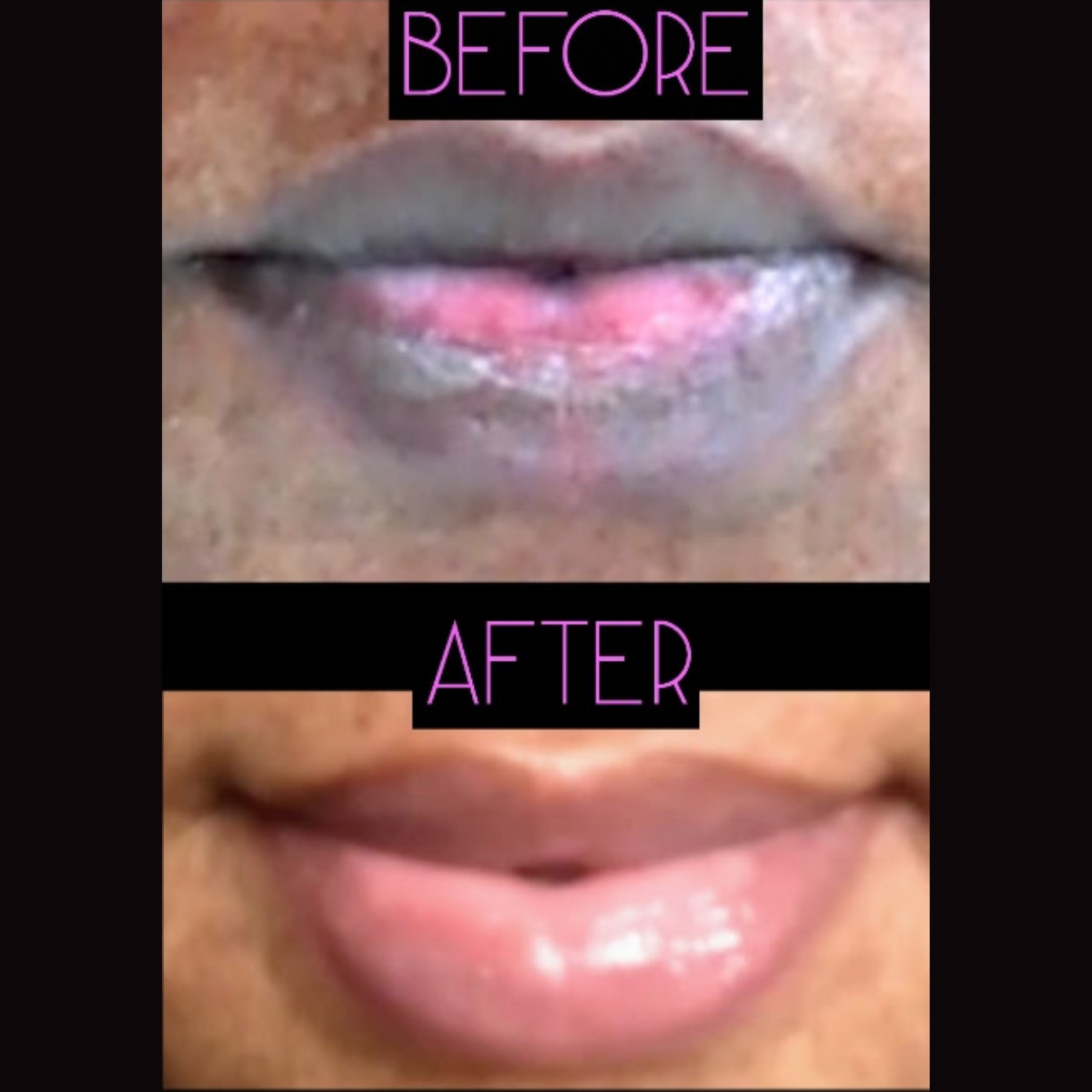 Lip Restoration Kit Lip Balms & Treatments Lip Tease by Dallace