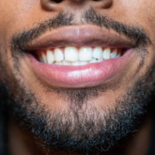 Lip Brightening Sample Kit (Mens) Lip Balms & Treatments Lip Tease by Dallace