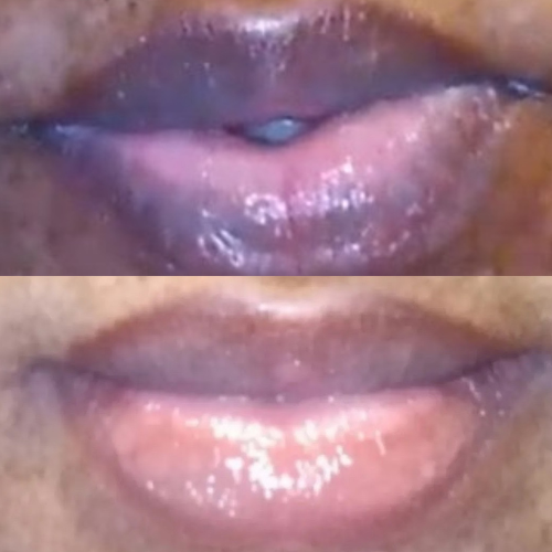 Lip Brightening Sample Kit (Womens) Lip Balms & Treatments Lip Tease by Dallace