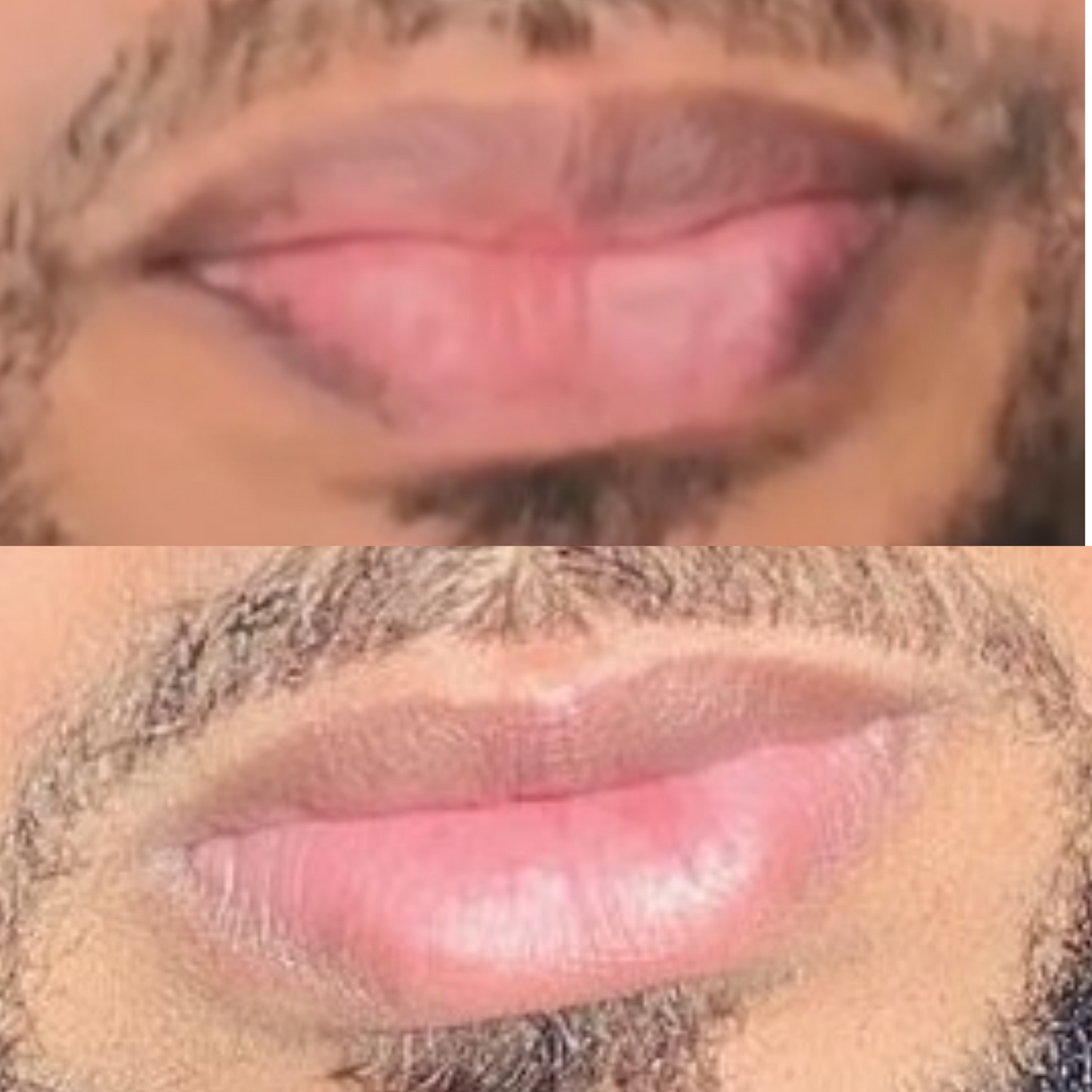 Lip Lightening Balm (Mens) Lip Balms & Treatments Lip Tease by Dallace