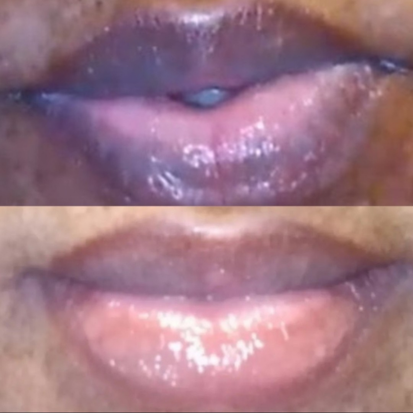 Lip Restoration Kit Lip Balms & Treatments Lip Tease by Dallace