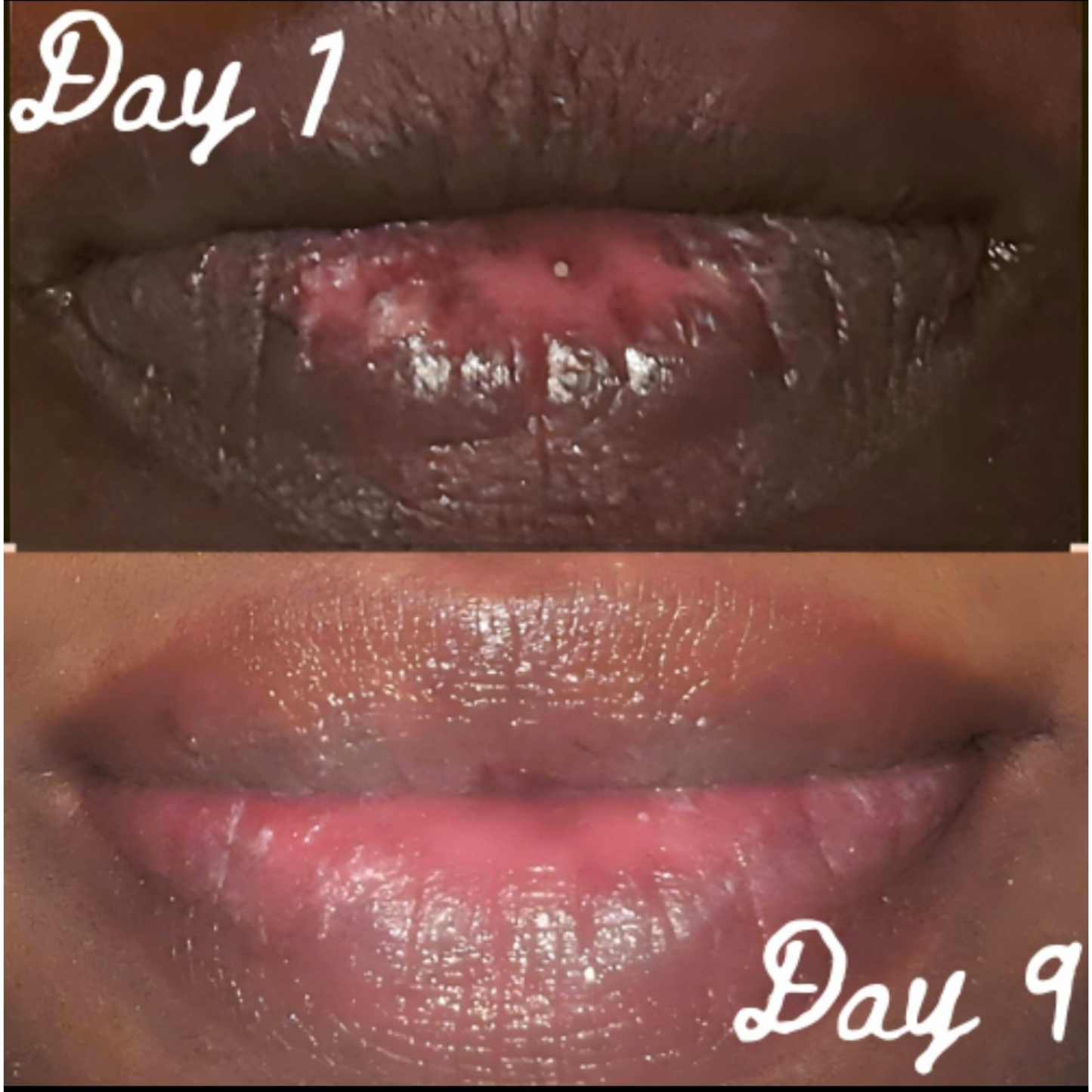 Lip Restoration Kit Lip Balms & Treatments Lip Tease by Dallace