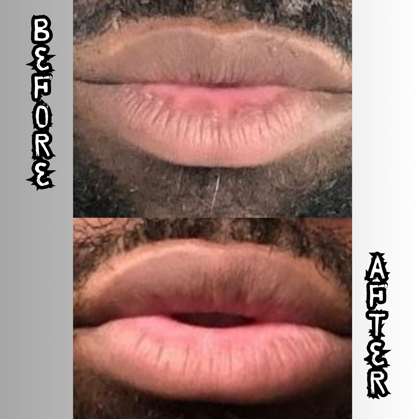 Lip Restoration Kit (For Men) Lip Balms & Treatments Lip Tease by Dallace