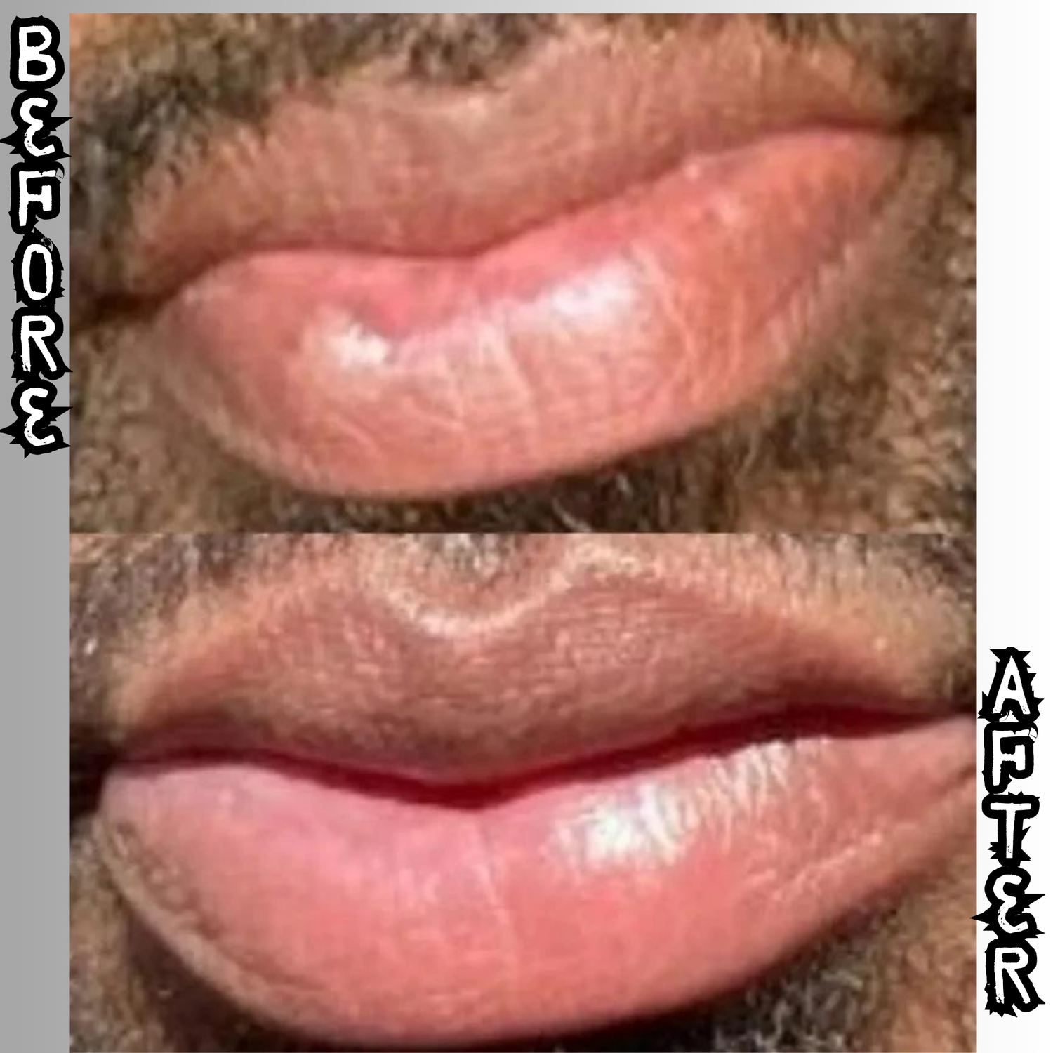 Lip Restoration Kit (For Men) Lip Balms & Treatments Lip Tease by Dallace