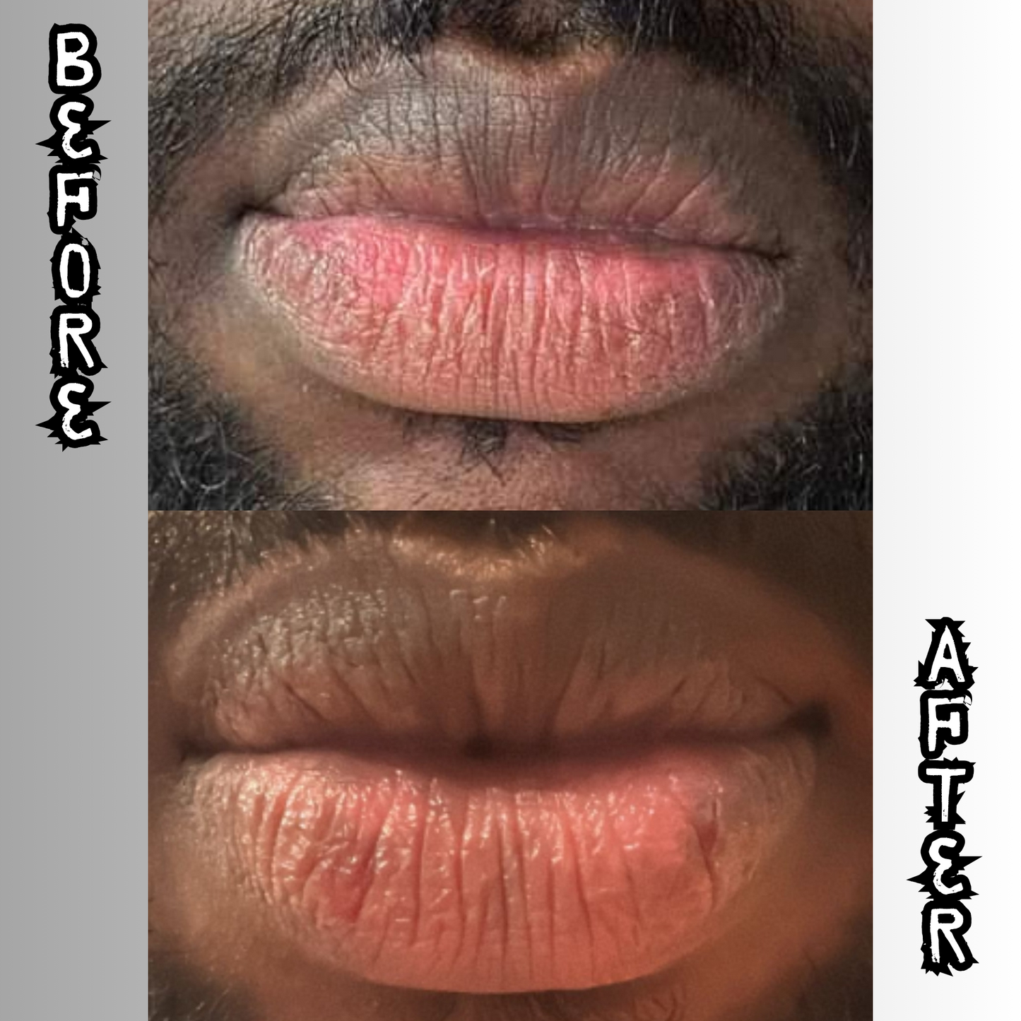 Lip Restoration Kit (For Men) Lip Balms & Treatments Lip Tease by Dallace