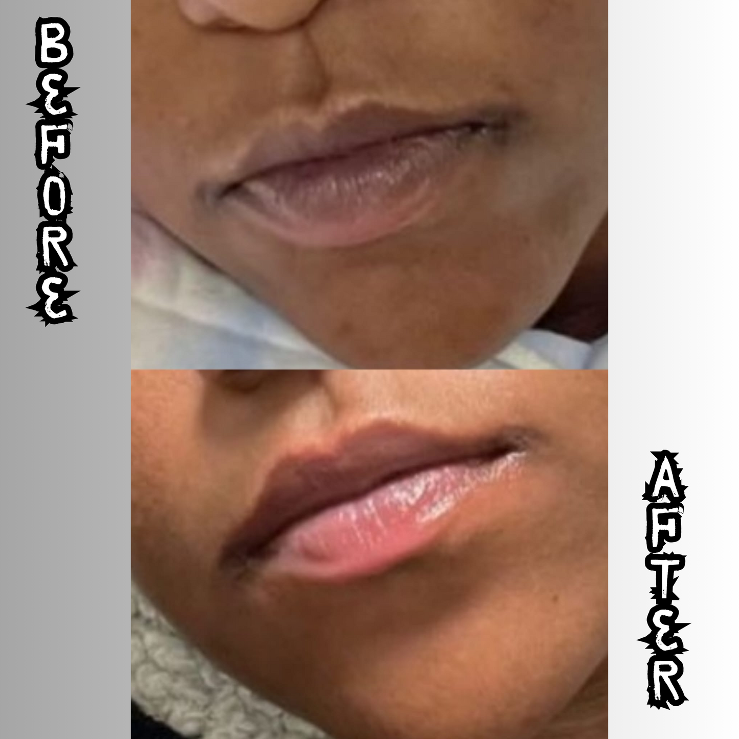 Lip Restoration Kit (For Men) Lip Balms & Treatments Lip Tease by Dallace