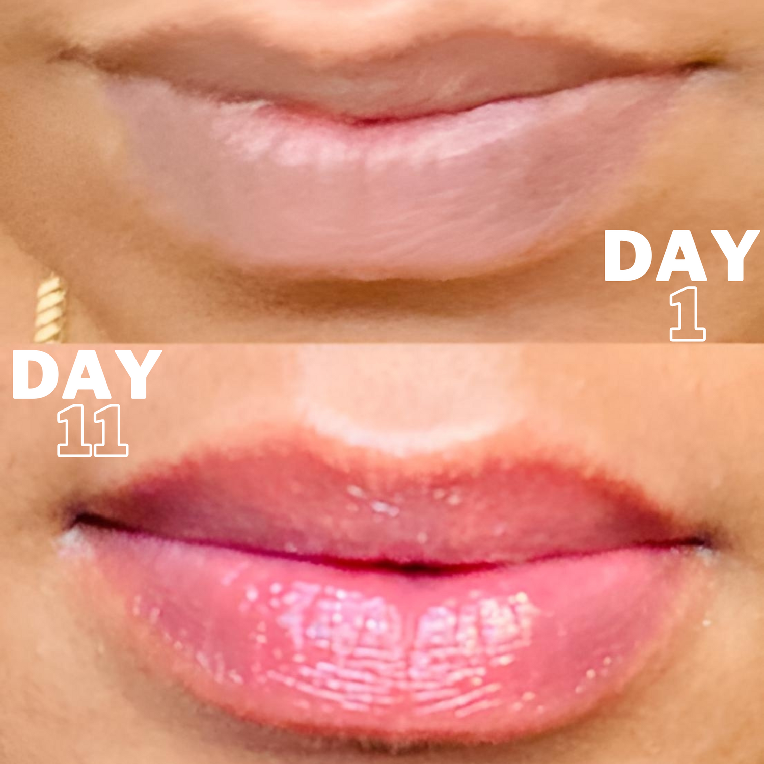 Lip Restoration Kit Lip Balms & Treatments Lip Tease by Dallace