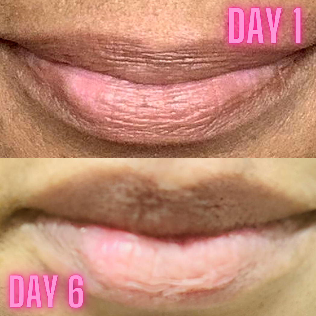 Lip Brightening Sample Kit (Womens) Lip Balms & Treatments Lip Tease by Dallace