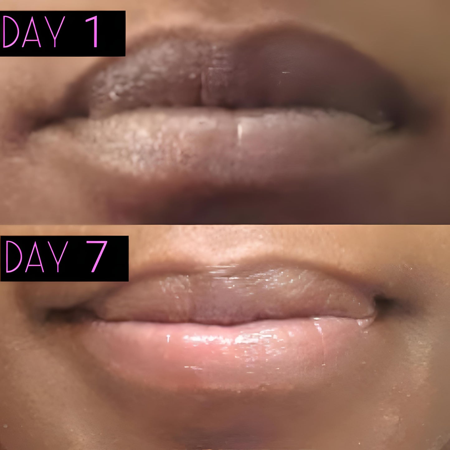 Lip Lightening Balm Lip Balms & Treatments Lip Tease by Dallace
