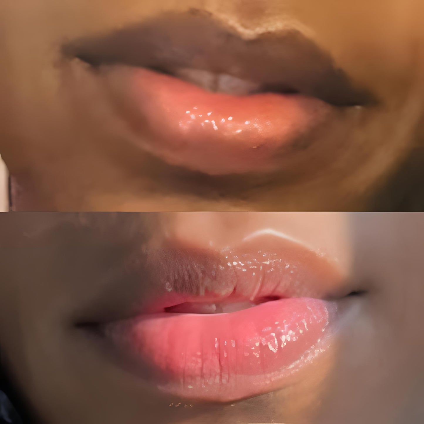 Lip Restoration Kit Lip Balms & Treatments Lip Tease by Dallace