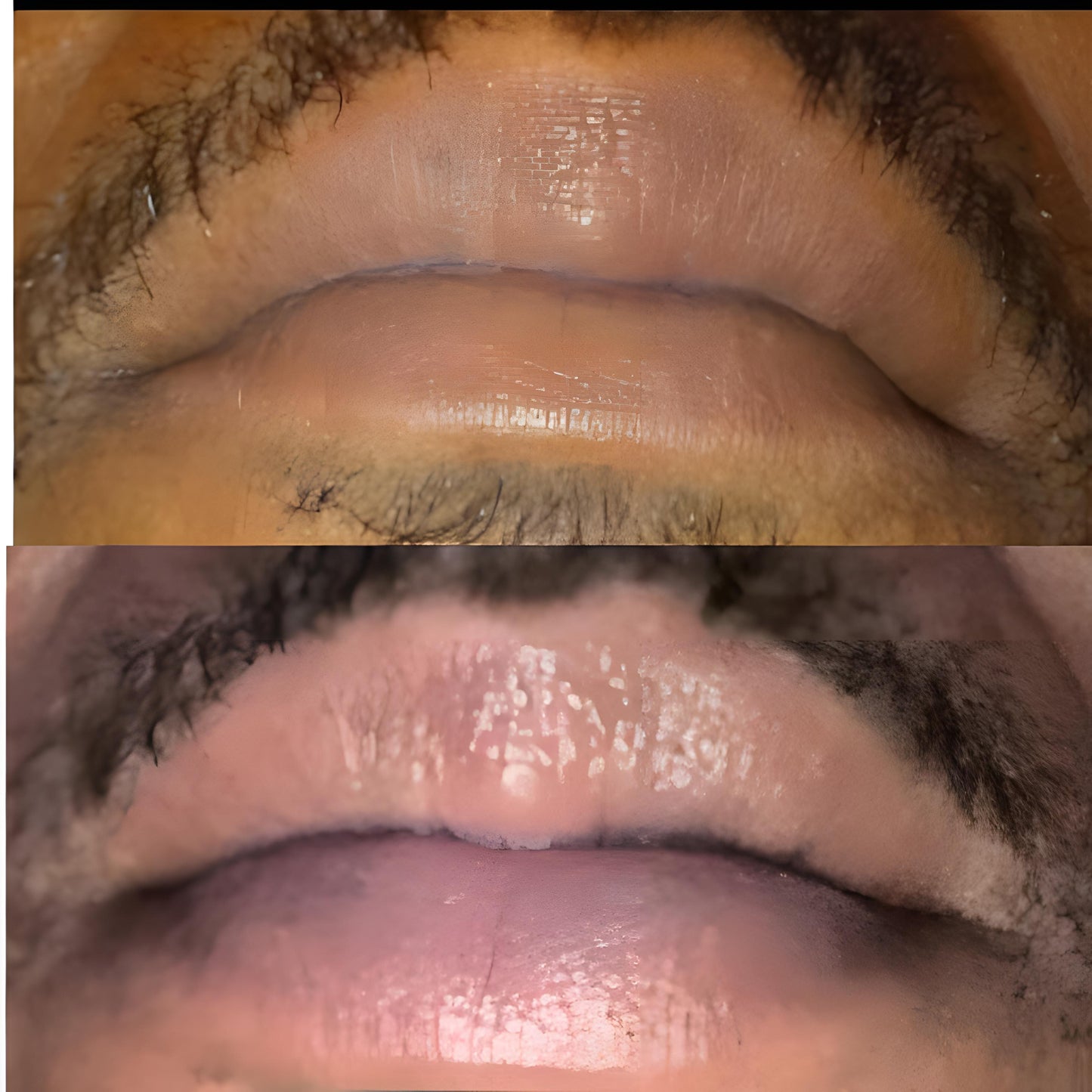 Lip Brightening Sample Kit (Mens) Lip Balms & Treatments Lip Tease by Dallace