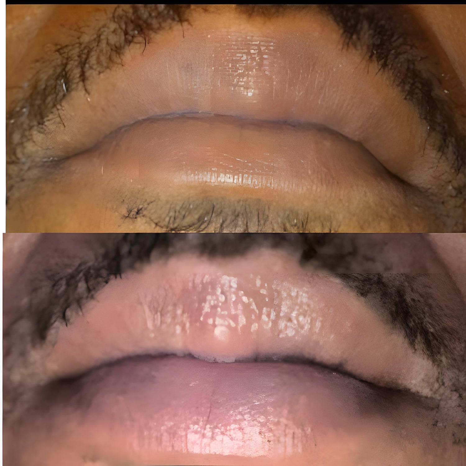 Lip Brightening Sample Kit (Mens) Lip Balms & Treatments Lip Tease by Dallace