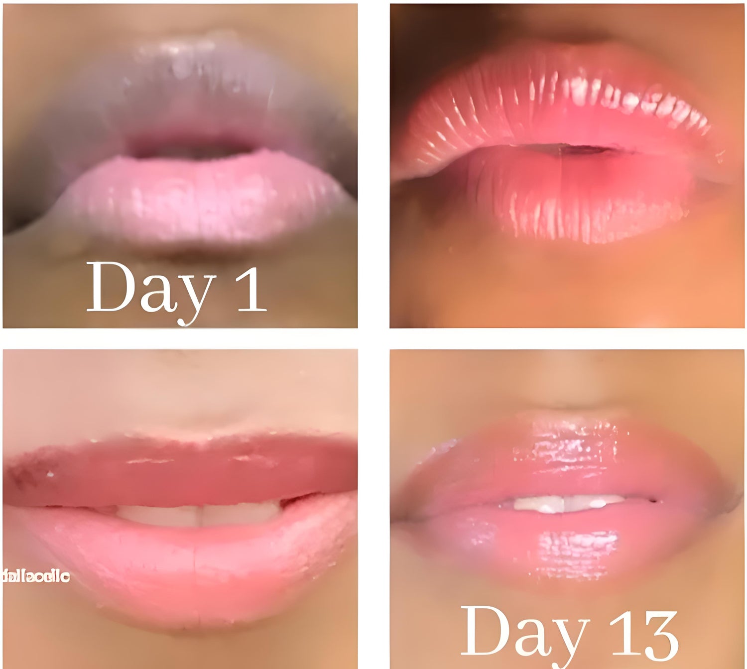 Lip Lightening Balm Lip Balms & Treatments Lip Tease by Dallace