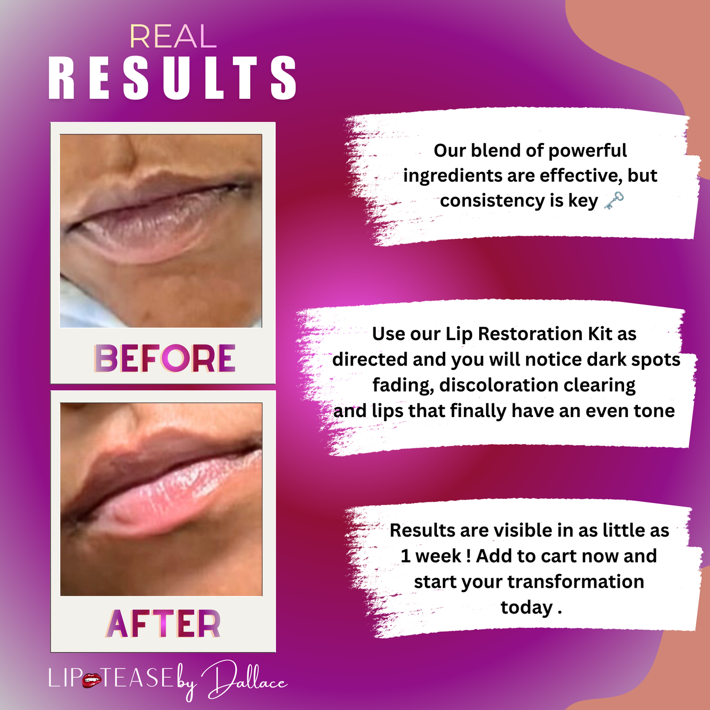 Lip Restoration Kit