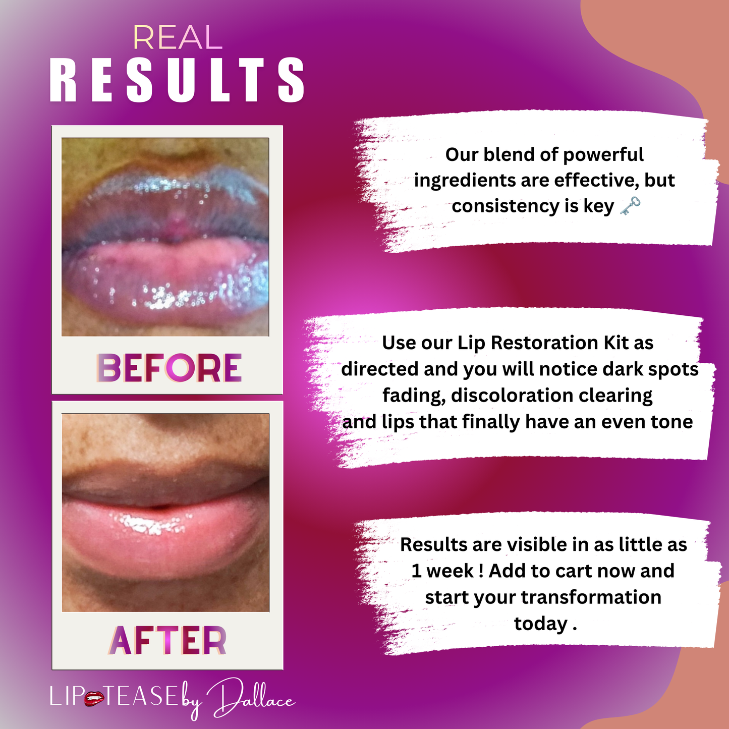 Lip Restoration Kit