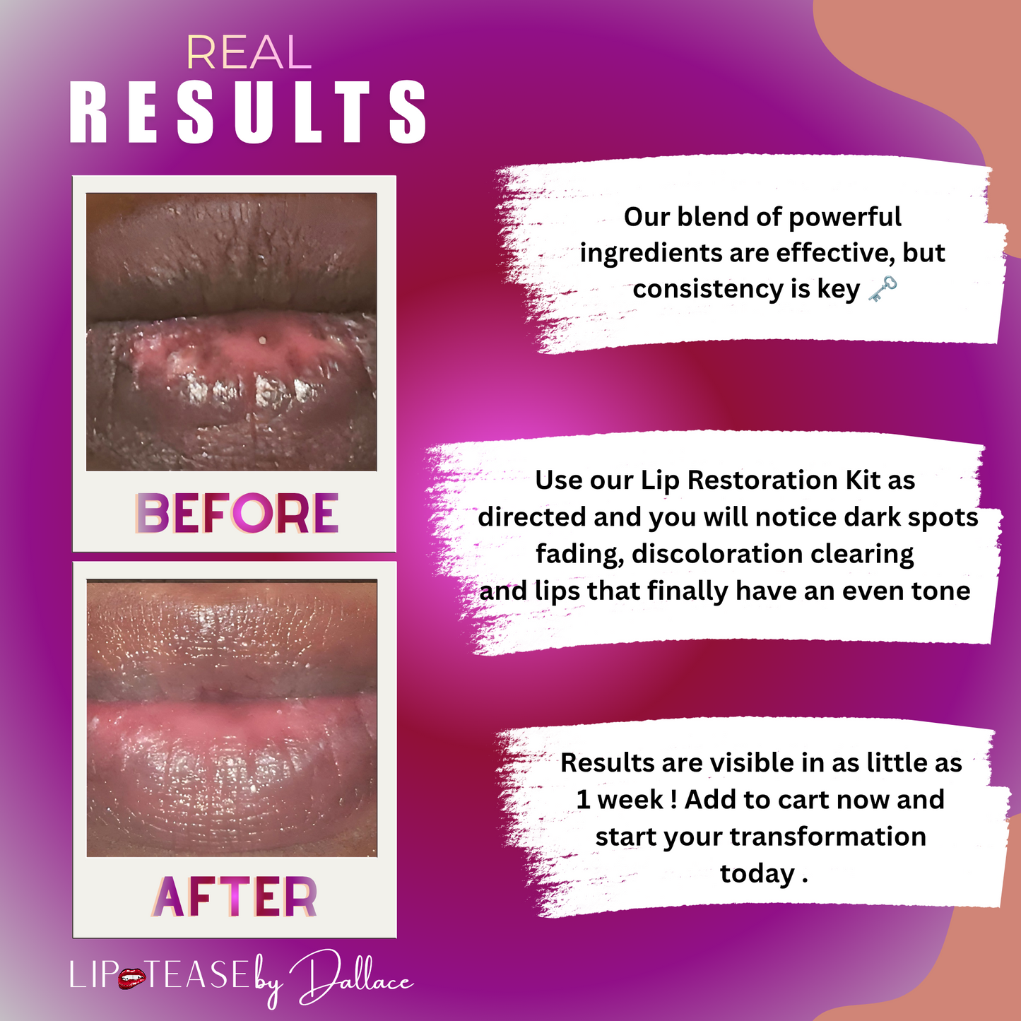 Lip Restoration Kit