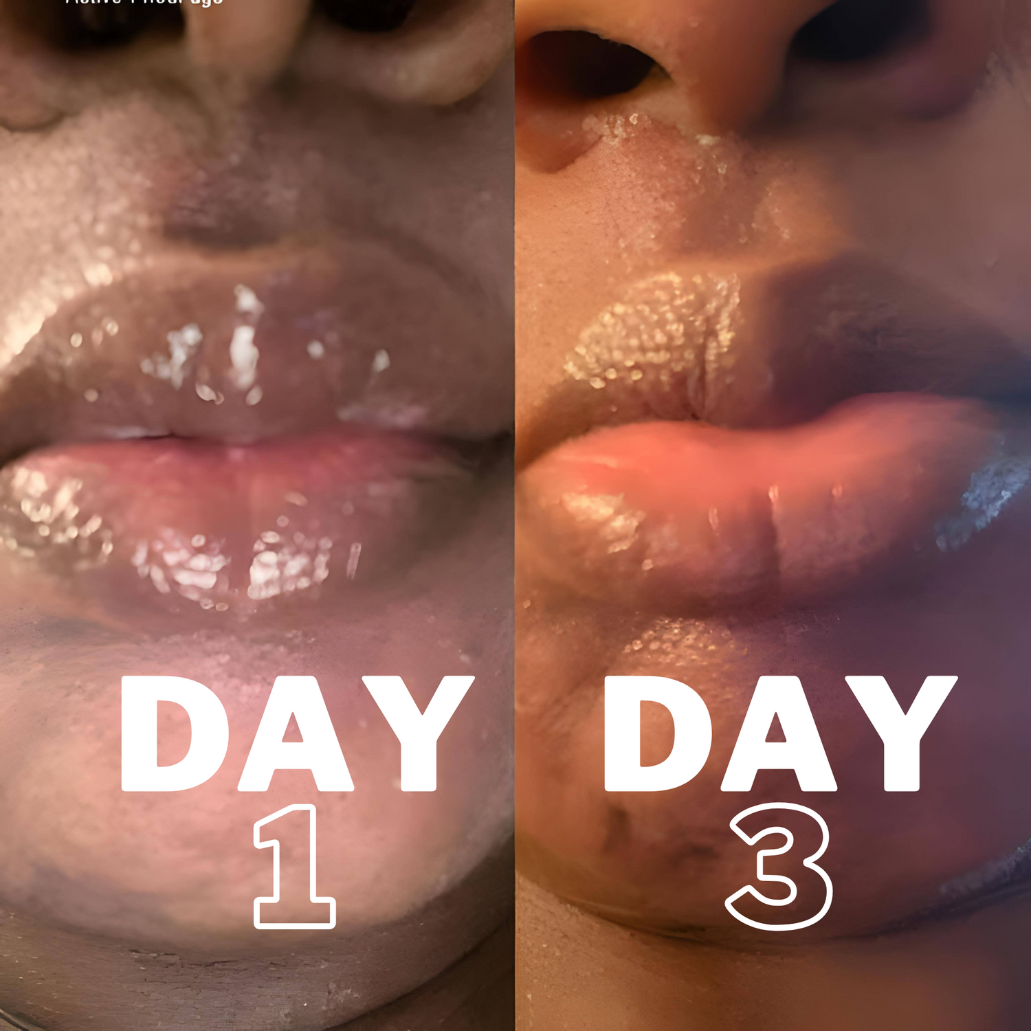 Lip Lightening Balm Lip Balms & Treatments Lip Tease by Dallace    