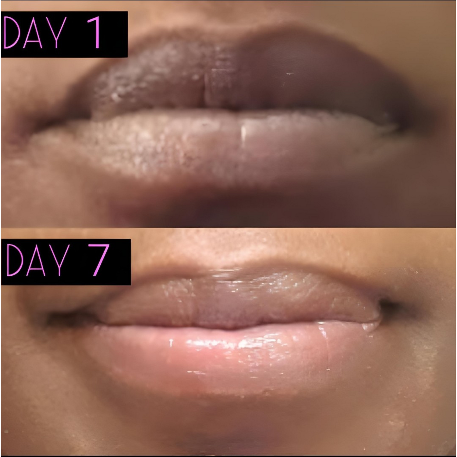 Lip Restoration Kit Lip Balms & Treatments Lip Tease by Dallace   