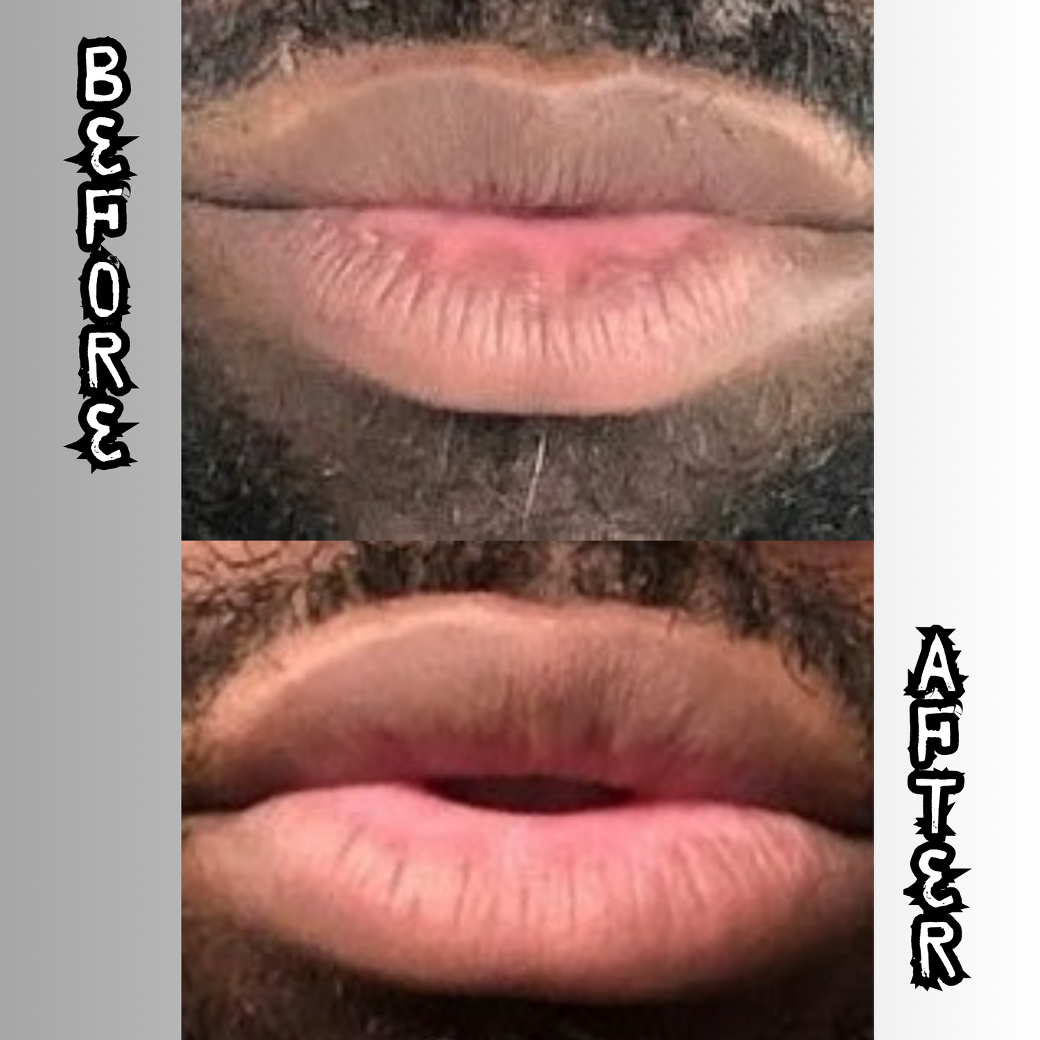 Lip Restoration Kit (For Men) Lip Balms & Treatments Lip Tease by Dallace   
