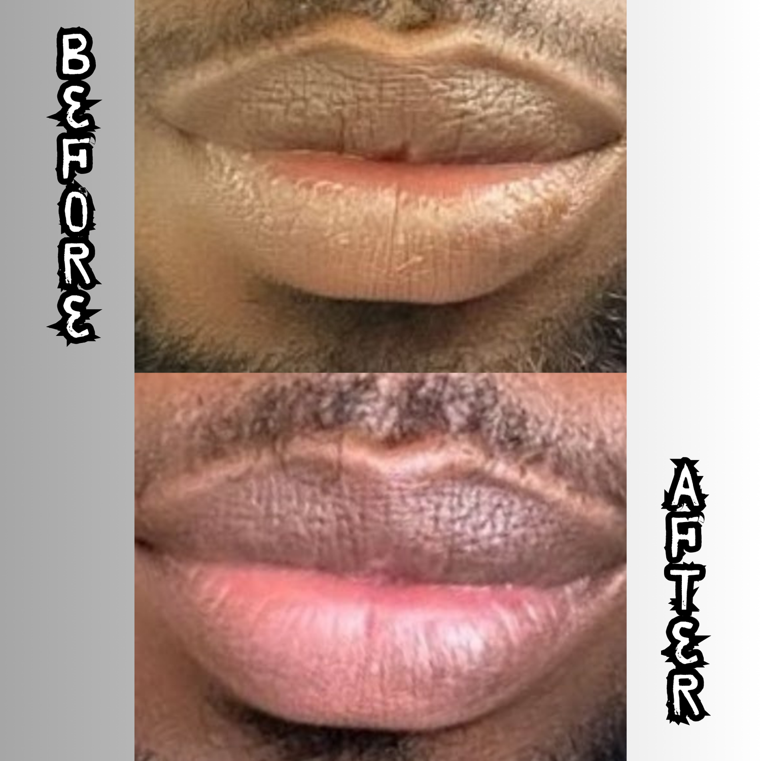 Lip Restoration Kit (For Men) Lip Balms & Treatments Lip Tease by Dallace   