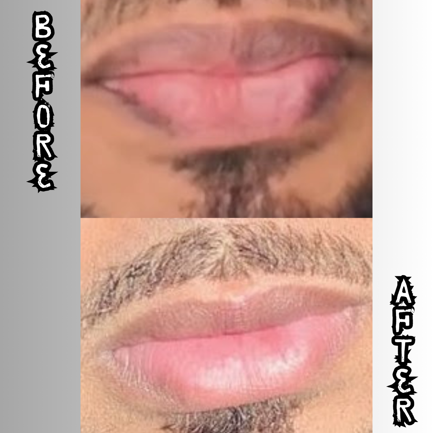 Lip Restoration Kit (For Men) Lip Balms & Treatments Lip Tease by Dallace   
