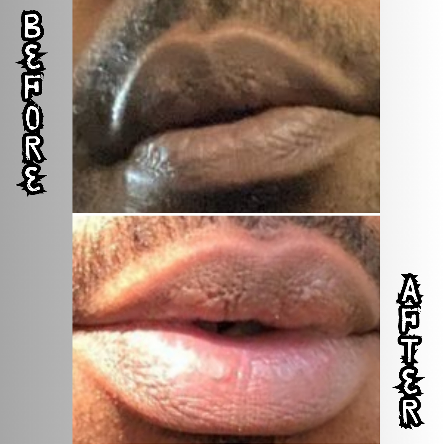 Lip Restoration Kit (For Men) Lip Balms & Treatments Lip Tease by Dallace   