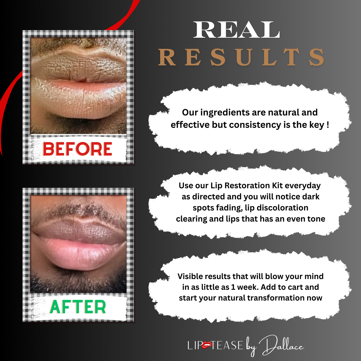 Lip Restoration Kit (For Men)