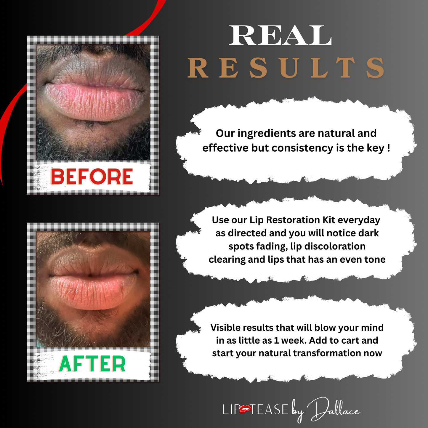 Lip Restoration Kit (For Men)