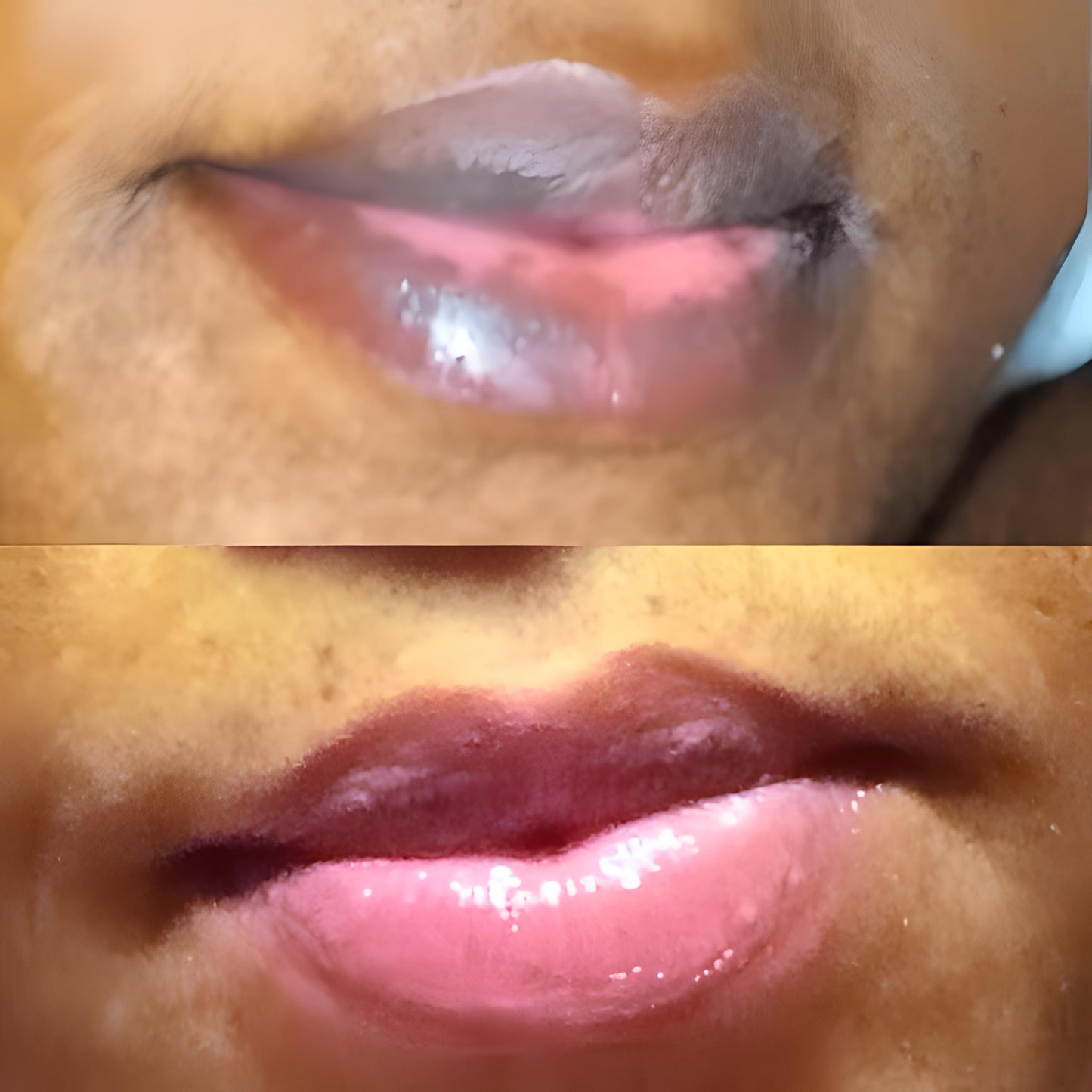 Lip Restoration Kit Lip Balms & Treatments Lip Tease by Dallace   